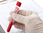 مجلس الصحة الخليجي: تحليل الدم هو الطريقة الوحيدة لمعرفة معادن الجسم