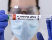 سجّل 50 طفرة جينية.. دراسة ترصد تسارعاً كبيراً في تحوّر فيروس “جدري القرود”
