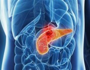 سرطان البنكرياس.. أسبابه وأعراضه وطرق الوقاية