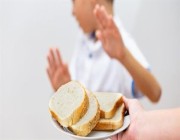 “الصحة” توضح الخدمات المقدمة لمرضى حساسية القمح