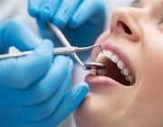 طبيب مختص يوضح أكثر أنواع حشوات الأسنان شيوعًا.. وهذه ضوابط “ابتسامة هوليود”
