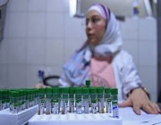 عاجل.. 14 وفاة بالكوليرا في سوريا و201 إصابة