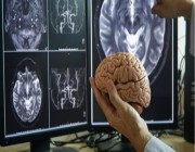 تطوير شريحة عصبية لعلاج اضطرابات الدماغ