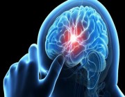 السكتة الدماغية.. أعراضها والفئات الأكثر تعرضا للإصابة