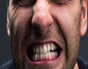 “صرير الأسنان”.. الأسباب والعواقب والعلاج