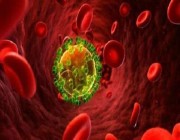 8 عوامل تساعد مريض نقص المناعة الأولية على تقليل الإصابة بالعدوى