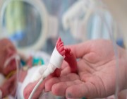 “سعود الطبية” تُبرز العوامل التي قد تؤدي للولادة المُبكرة