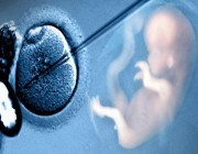99 % نجاح الحقن المجهري لتحديد جنس الجنين