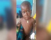 نجاة طفل أوغندي عمره عامان بعد أن ابتلعه فرس النهر