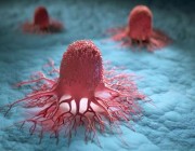 منها الإجهاد.. علماء يكتشفون أسباباً غير عادية لتطور الخلايا السرطانية