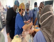 استشارية لـ”أخبار 24″: التوأم السيامي العراقي خضع لجراحة تجميل قبل عملية الفصل
