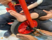 “الدفاع المدني” يحرر قدم طفل علقت في دراجة بالشرقية