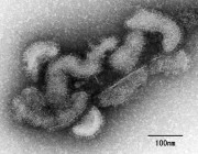 اليابان تعلن عن أول حالة وفاة في العالم بفيروس “أوز”