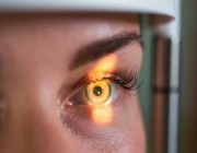 الكشف عن علامات في العين تعني الإصابة بمرض لا دواء له