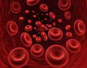 اختصاصي الدم والأورام: الإرهاق وبرودة الأطراف وشحوب الوجه من أهم أعراض الإصابة بفقر الدم