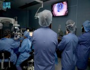 الأولى من نوعها في الشرق الأوسط .. مستشفى “التخصصي للعيون ” يجري عملية “اندو إن” لزراعة البطانة الداخلية