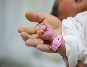 إيطاليا تمنح الجنسية لرضيعة من بريطانيا لمنع فصل أجهزة دعم الحياة عنها