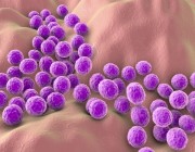 “البكتيريا” تسبب “الإكزيما”
