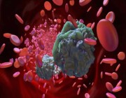 نتائج واعدة لعلاج جديد يستهدف أشرس أنواع سرطان الدم