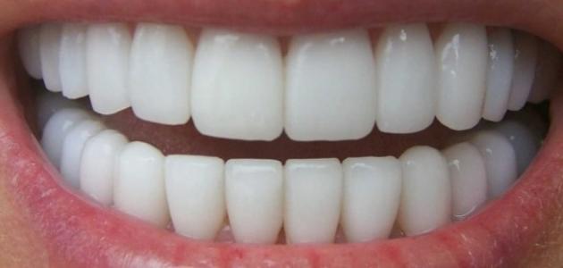 اكتشاف طريقة آمنة لتبييض الأسنان في 4 ساعات