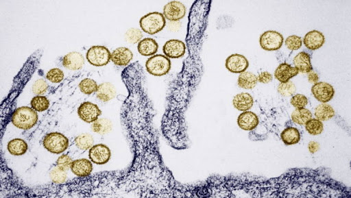 6 أعراض لـ فيروس هانتا فما هي؟