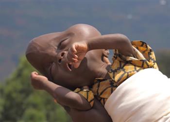 والده وصفه بـ”الشيطان” وطلب من الأم قتله.. مرض نادر يشوه ملامح طفل رواندي (فيديو وصور)