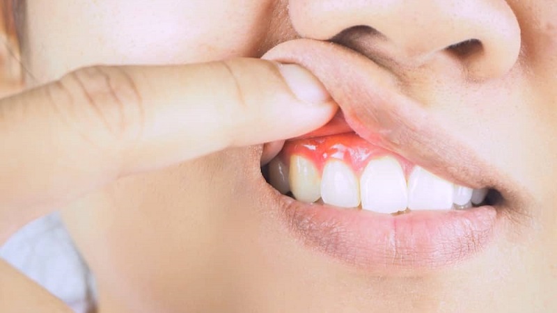 إشارات يرسلها الجسم.. 5 أمراض خطيرة يمكن اكتشافها عن طريق الفم