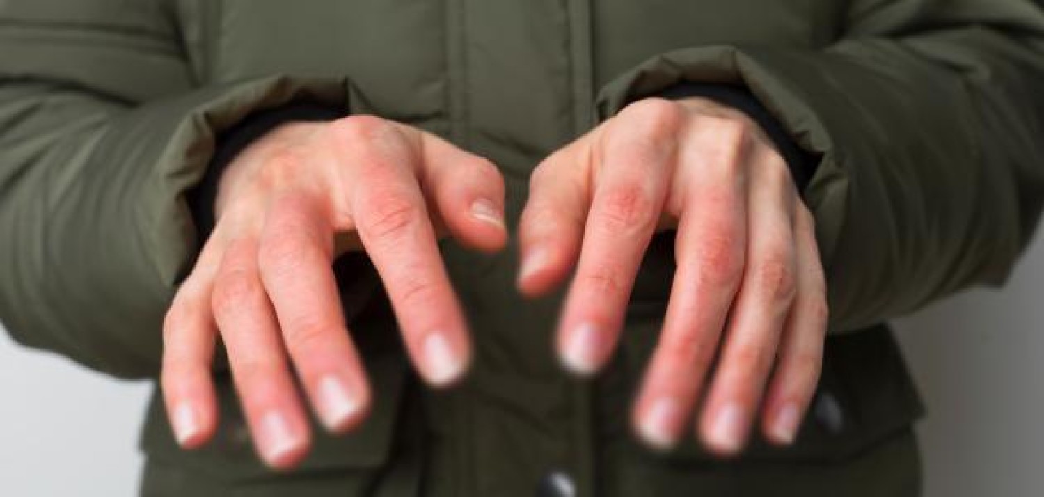 البرودة في أطراف أصابعك دليل على مرض خطير ..دراسة توضح