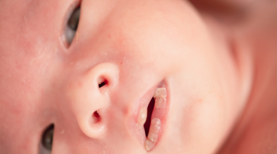 3 علامات تدل على إصابة الطفل الرضيع بالجفاف