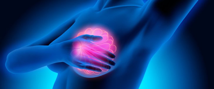 8 خرافات عُرفت عن سرطان الثدي.. تعرفي عليهم