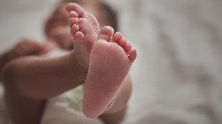 ولادة طفلة بذيل يبلغ طوله 6 سم «مغطى بالشعر والجلد»