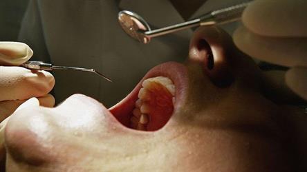 علماء يقتربون من علاج غير مسبوق يتيح للأسنان النمو مرة أخرى