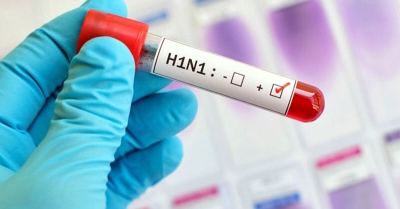 أول إصابة بشرية بـ"إنفلونزا H1N1" ببريطانيا
