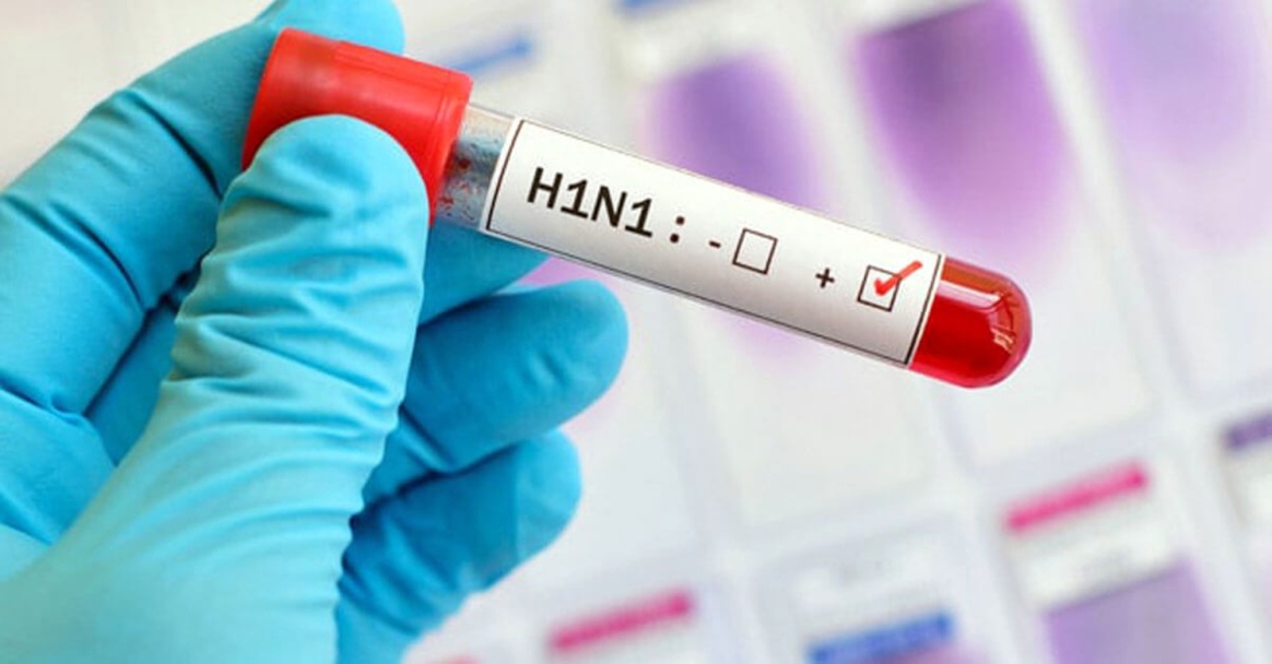 أول إصابة بشرية بـ”إنفلونزا H1N1″ ببريطانيا
