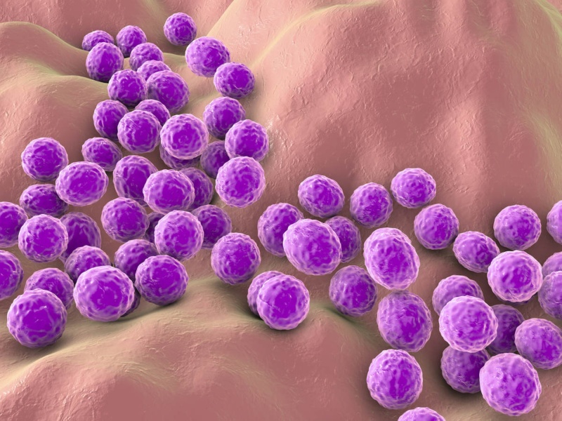 “البكتيريا” تسبب “الإكزيما”