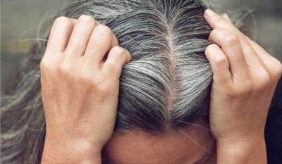 أطعمة تقاوم "الشيب" المُبكر