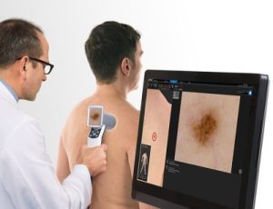 'فيكترا 360' لتشخيص سرطان الجلد بالذكاء الاصطناعي